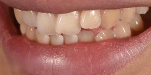 Your Perfect Smile, Redefined